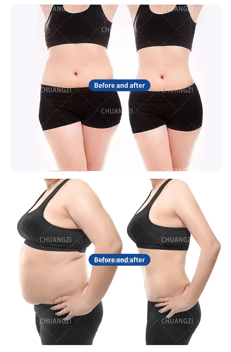 EMSZERO Hi EMT RF Machine for Body Sculpting and Slimming