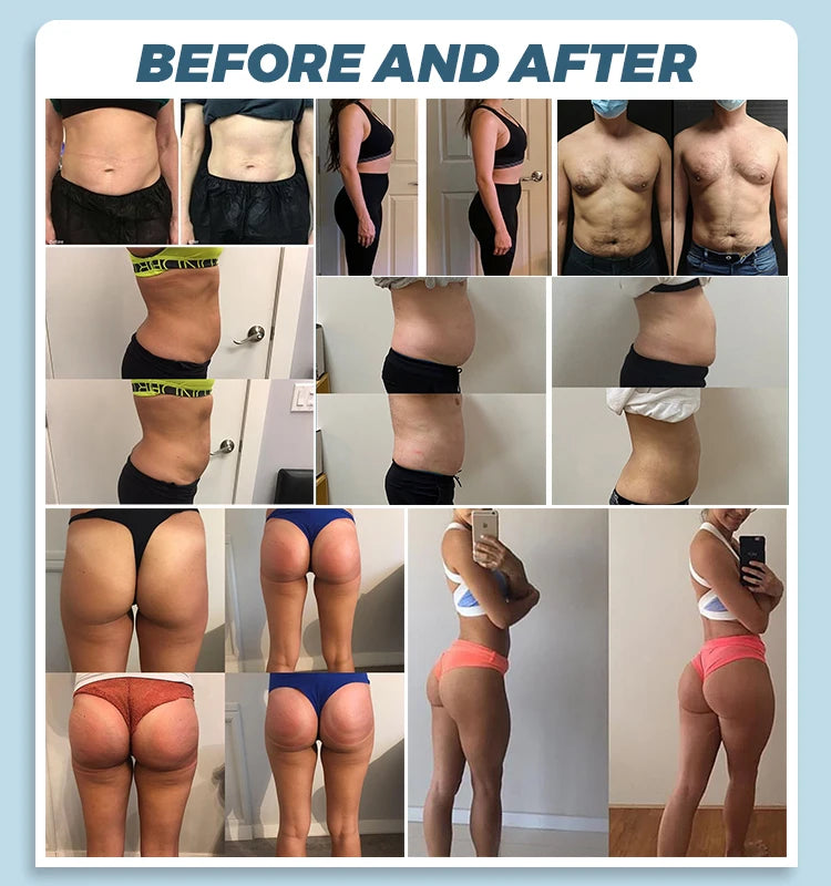 EMSZERO Hi EMT RF Machine for Body Sculpting and Slimming